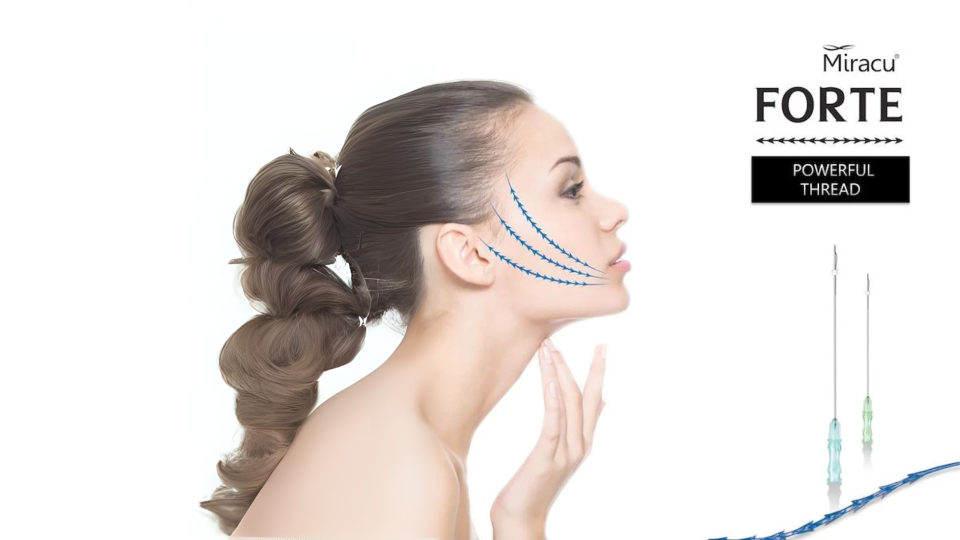 Fili di biostimolazione: caratteristiche e metodologia